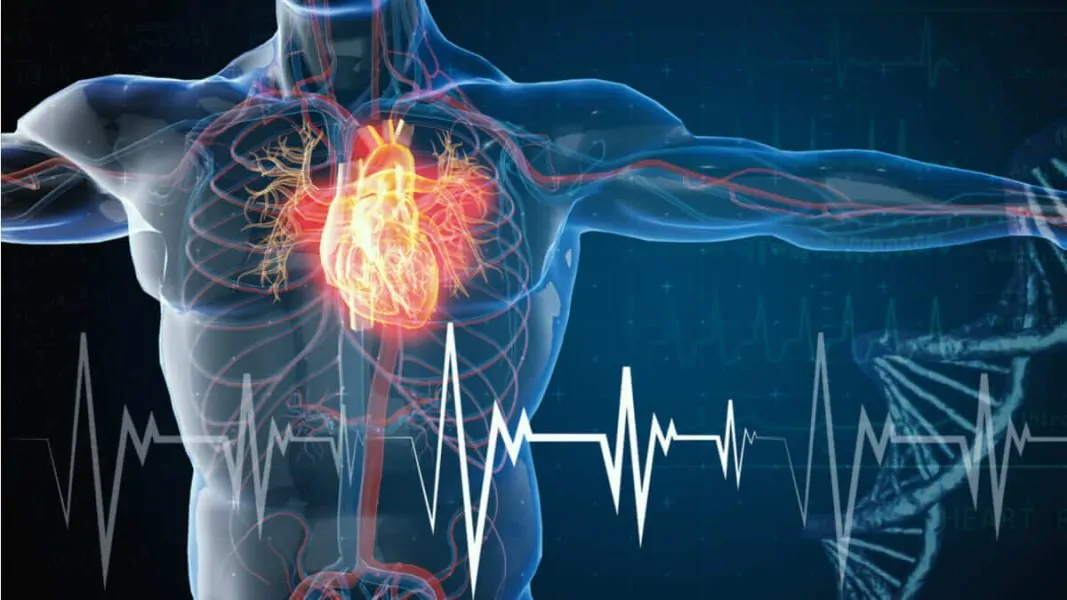 BIGDATA CARDIOMIOPATÍA ISQUÉMICA