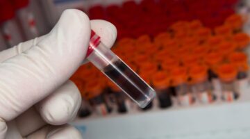 Bogotá intensifica la detección temprana del VIH: Estrategias para mejorar la calidad de vida y reducir el estigma