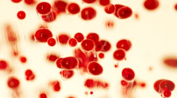 Bogotá refuerza medidas tras caso de meningococemia e insta a la calma