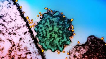 Brote de virus Nipah en India ¿estamos en riesgo