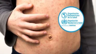 Brotes de sarampión en 10 países de las Américas: OPS advierte riesgo regional por baja cobertura de vacunación