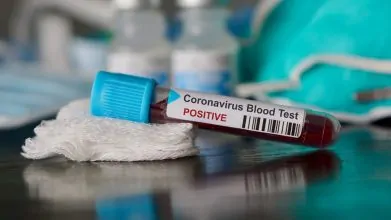 CORONAVIRUS, FAKES NEWS, OMS