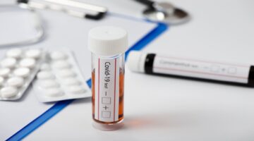 Cambios en el reconocimiento y pago de pruebas Covid-19