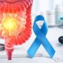 Cáncer de colon en jóvenes alerta a Colombia y refuerza el llamado a la detección temprana