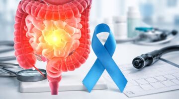 Cáncer de colon en jóvenes alerta a Colombia y refuerza el llamado a la detección temprana