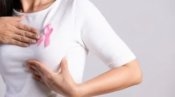 Cáncer de mama en Colombia - Avances en oportunidad terapéutica, pero persisten desafíos en diagnóstico temprano