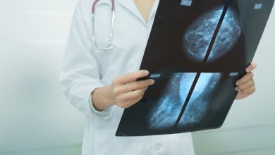 Cáncer de mama sería detectado 2 años antes del diagnóstico con prueba de sangre