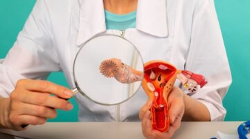 Cáncer de ovario La importancia del diagnóstico temprano y su impacto en el tratamiento.jpg