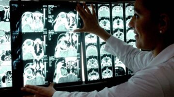 Capacitan a 3.000 profesionales de salud en México para mejorar el diagnóstico temprano del ictus