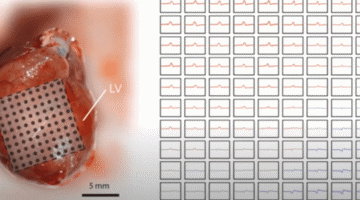 Científicos desarrollan marcapasos mínimamente invasivo activado por luz
