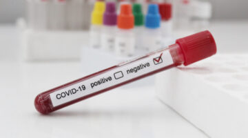 Casos sospechosos de Covid-19 que resulten negativos deben aislarse​​
