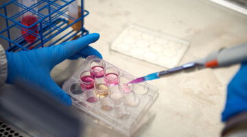 Células vitales en inmunoterapia para tratar el cáncer