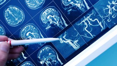 Científicos identifican nueva forma de autismo