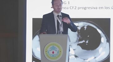 Codebreak 200: resultados posicionan al sotorasib en el tratamiento del cáncer de pulmón