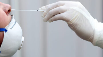 Condiciones para el reconocimiento y pago de pruebas Covid-19 a EPS