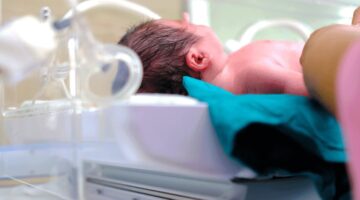 Corticoesteroidesaumenta supervivencia de bebes 2020