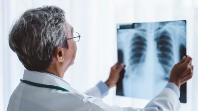 Corticosteroides e inmunoterapia una combinación con efectos adversos en pacientes con cáncer de pulmón