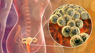 Crean dispositivo para diagnosticar la gonorrea en menos de 15 minutos