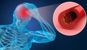 Crean nanopartículas transportadoras de fármacos que cruzan la barrera hematoencefálica