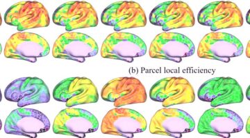 Crean primer atlas del cerebro infantil revela pistas de neurodesarrollo