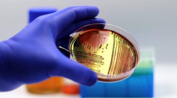 Crean técnica que previene la resistencia a los antibióticos en infecciones intrahospitalarias