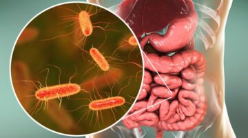 Crisis global por el cólera la OMS advierte aumento de muertes y contagios