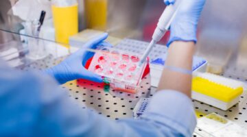 Células mesenquimales