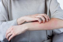 Un estudio revela la relación entre la enfermedad inflamatoria intestinal y la dermatitis atópica