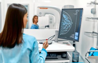 Descubrimientos sorprendentes desafían el modelo unicelular del cáncer de mama