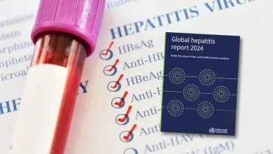 Día Mundial contra la Hepatitis: 1,3 millones de muertes anuales que aún pueden prevenirse