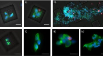 Diminuto dispositivo identifica el cáncer metastásico