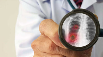 Directrices para la atención temprana del coronavirus