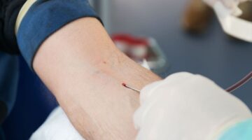 Drepanocitosis anemia 2020