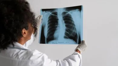 EMA recomienda la aprobación del primer tratamiento para la enfermedad pulmonar crónica BNCF