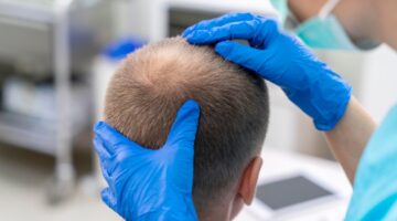 EMA revisa fármacos para alopecia tras reportes de ideación suicida