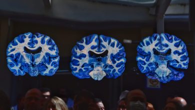 El cerebro azul: fotografía en alta definición que revoluciona el estudio neurocientífico