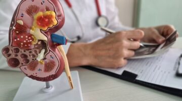 El riñón bioartificial implantable: una esperanza para los pacientes con insuficiencia renal