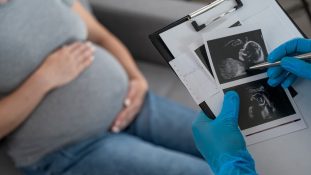 En 2023, los nacimientos en Estados Unidos cayeron a niveles de 1979