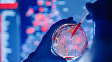 En África crecen las muertes por resistencia a los antimicrobianos