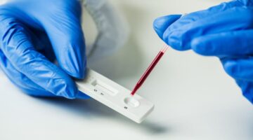 En Brasil prueba rápida covid-19