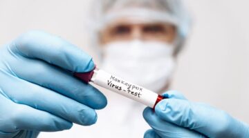 En Perú detectan primer caso de viruela del mono