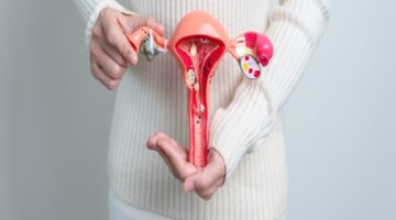 Endometriosis impacto en la fertilidad y opciones de tratamiento para mujeres en edad reproductiva