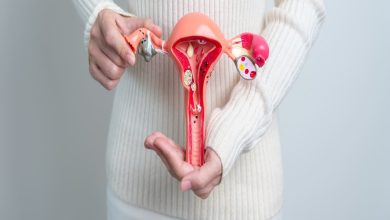 Endometriosis impacto en la fertilidad y opciones de tratamiento para mujeres en edad reproductiva
