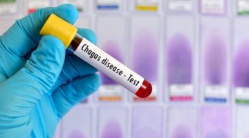 Enfermedad de Chagas pone en riesgo salud en Latinoamérica
