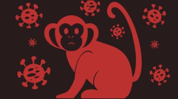 Estamos en emergencia de salud pública por viruela símica