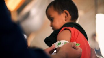 Este sería el protocolo de atención para bebés y niños con desnutrición aguda