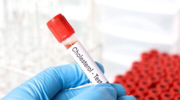 Estudio arroja resultados prometedores para reducir el colesterol