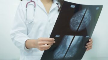 Estudio muestra los beneficios de las mamografías de control