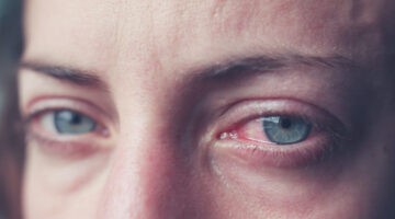 Estudio sugiere que el consumo de cannabis afecta la visión