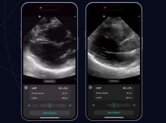 Exo potencia IA para diagnósticos por imagen desde smartphones